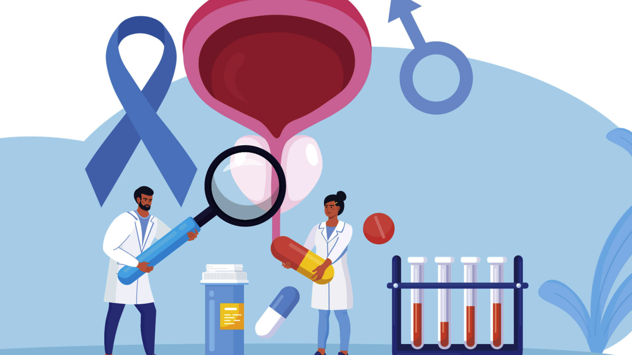 - Los tumores prostáticos son el tipo de cáncer de mayor incidencia en los hombres; a partir de los 40 años se deben seguir medidas precautorias para no poner en riesgo la vida y las finanzas.