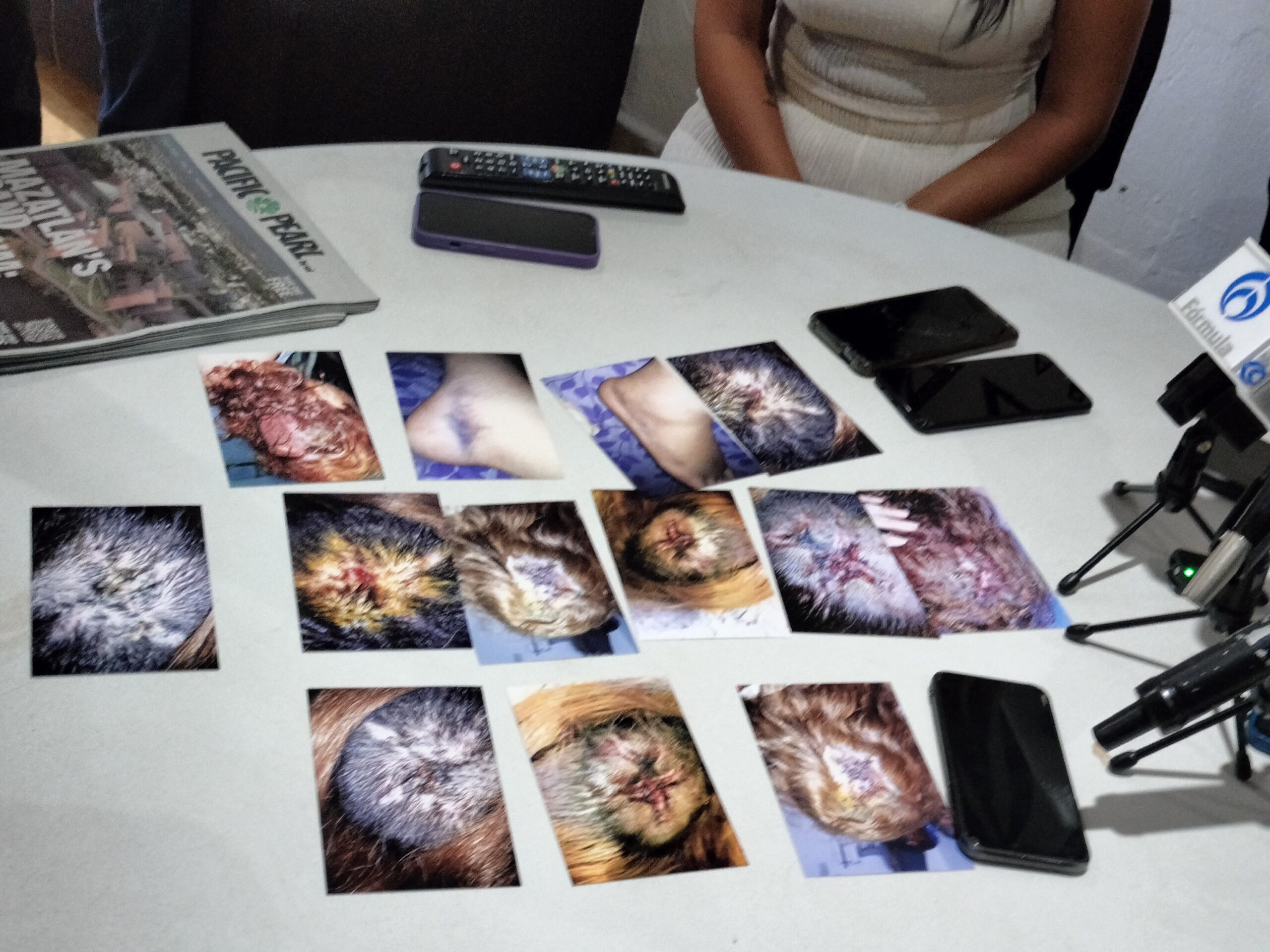 Accidentadas en cumplimiento de su deber en el 2020 y contando con dictámenes médicos y mandato judicial no les han cumplido su derecho a la pensión.