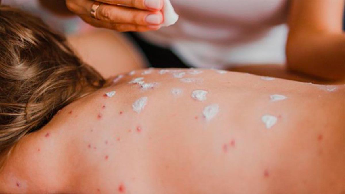 En cuanto a decesos, Chihuahua registra 21 y 1 en Sinaloa.